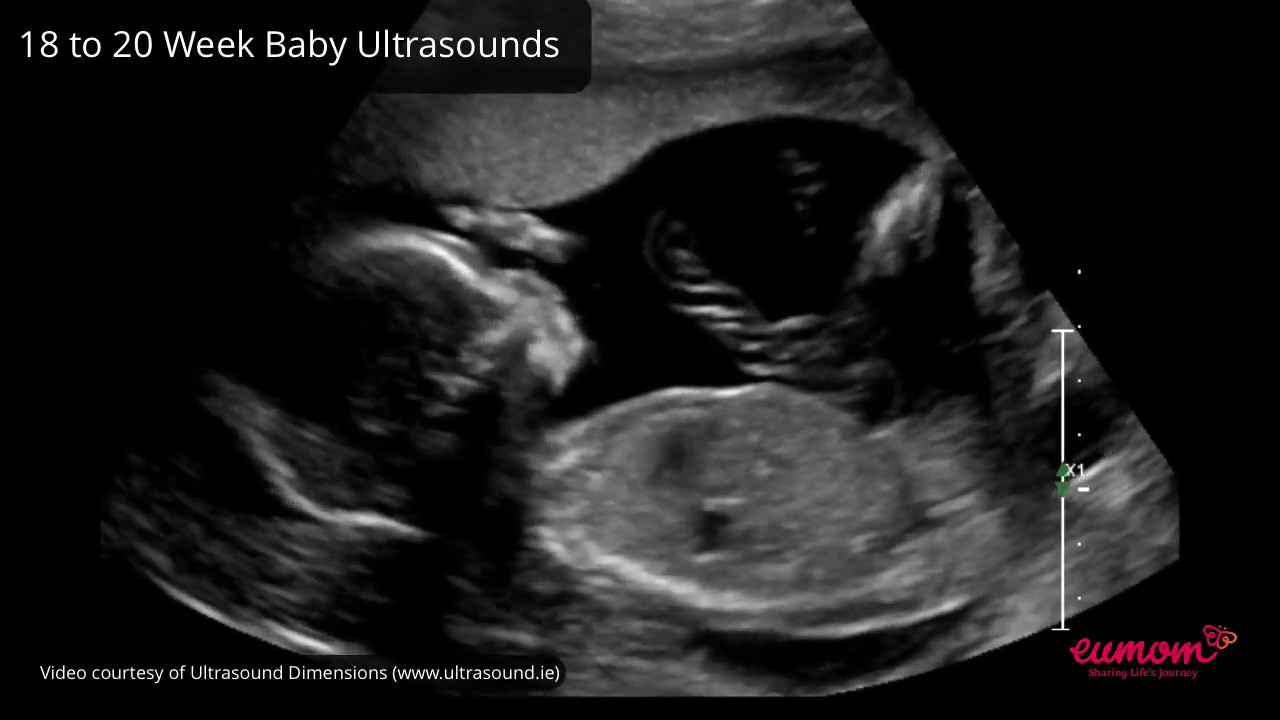 Ultrasound | Mary Street Medical Centre