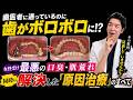 【男の清潔感】なぜ歯医者に通っているのに歯がボロボロに？女性受け最悪の「口臭・肌荒れ」を同時に解決した『原因治療』のすべて