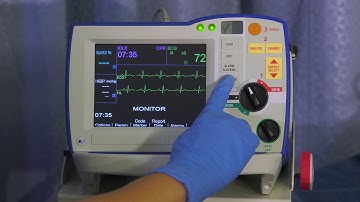 R Series Monitoring - v14