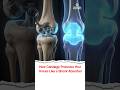 How Cartilage Protects Your Knees Like a Shock Absorber - Dr. Abhishek Barli