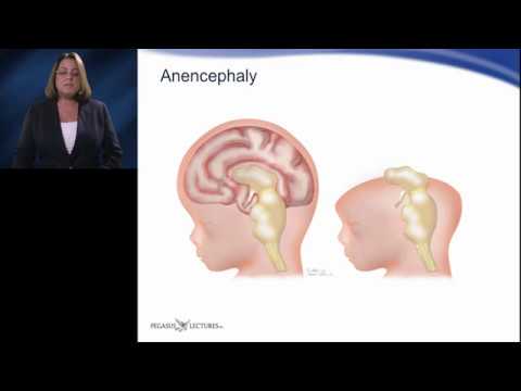 Video: Unterschied Zwischen Acrania Und Anencephalie