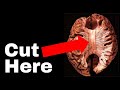 The unsettling truth about human consciousness  the split brain experiment that broke neuroscience