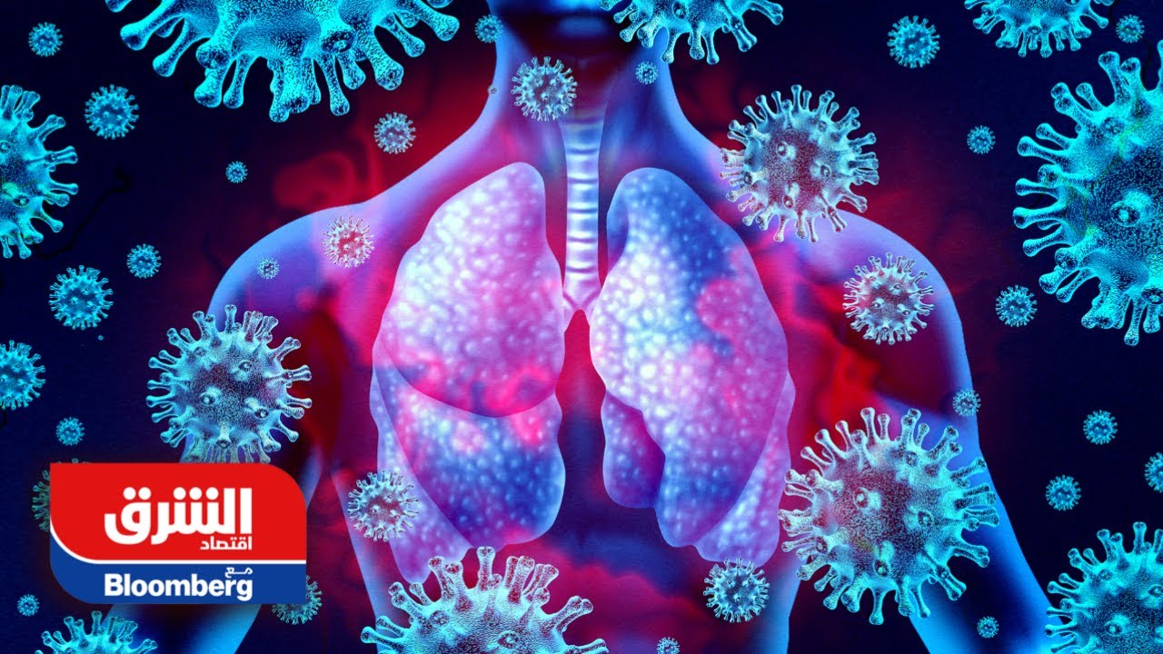 كشف تبعات كوفيد طويل الأمد.. إليكم التفاصيل