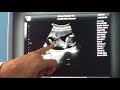 9 months of ultrasounds