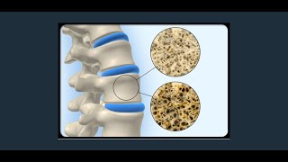 Disorders of Muscular and Skeletal System