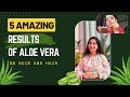 5 amazing benefits of aloe vera on skin and hair aloevera skincare