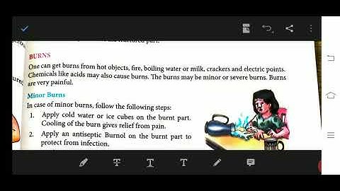 Class 5 science chapter 6 safety and first aid about Burns