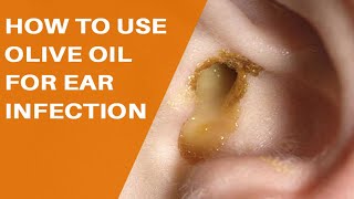 How to Use Olive Oil for Ear Infection