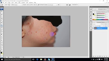 Tutorial 3.How to use clone stamp tool of adobe photoshop cloning remove pimples on face