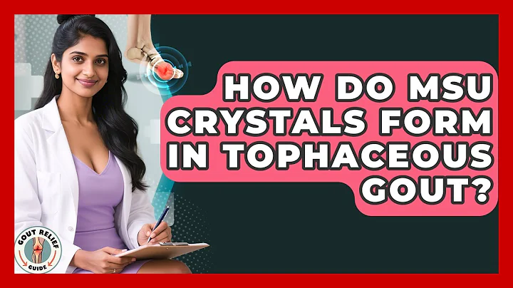 How Do MSU Crystals Form In Tophaceous Gout? - Gout Relief Guide