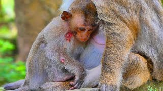 Pitiful Poor Baby Binya Really Hurt After Crazy Mother Bi_t....!