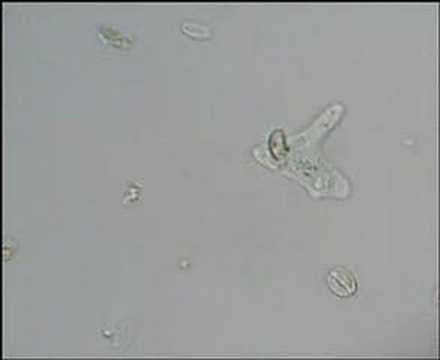 Amoeba