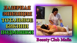 ЛАЗЕРНАЯ ЭПИЛЯЦИЯ БИКИНИ 🍓 ТОТАЛЬНОЕ БИКИНИ ГЛУБОКОЕ | ЭПИЛЯЦИЯ ПОДМЫШЕК | МАФИЯ - ЭПИЛЯЦИЯ В СОЧИ ЛАЗЕРНАЯ ЭПИЛЯЦИЯ БИКИНИ 🍓 ТОТАЛЬНОЕ БИКИНИ ГЛУБОКОЕ | ЭПИЛЯЦИЯ ПОДМЫШЕК | МАФИЯ - ЭПИЛЯЦИЯ В СОЧИ