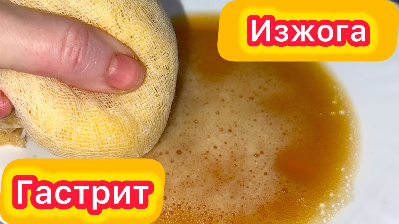 ИЗЖОГА, колит, , язва, гастрит. Вот почему нужно пить сок картошки.