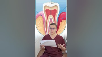 Nguyên nhân trám răng - bọc sứ xong lại bị hôi miệng?