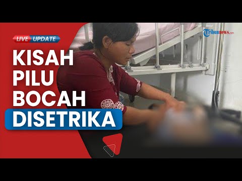 Bocah Yatim Disetrika Tante di Simalungun, Kesmida: Siap Asuh Korban dan Masukkan ke Dalam KK