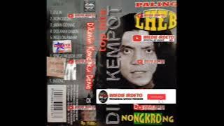 Didi Kempot - Jaran Goyang @wiedieirdeto