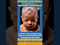 Baby Skull Anatomy | Anterior Fontanelle Explained 🧠 #bscnursing #nursingstudents