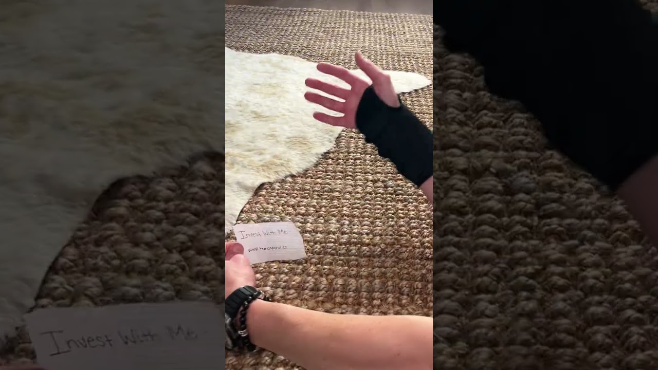 How I broke my arm.. 👀🤕 