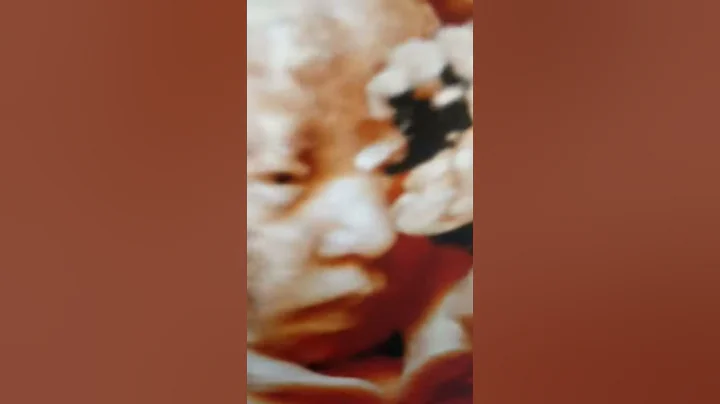 5D ULTRASOUND FACE  BABY OPENING EYES IN SCAN  DR SHARMA DIAGNOSTIC CENTRE DELHI