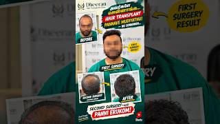 Told “Hair Transplant Is Not Possible”? 😳 See What Happened Next | Coimbatore