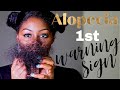 Alopecia: FIRST warning sign. What to look for.