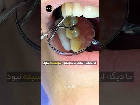 به جای خمیر دندان از نمک استفاده کنید
