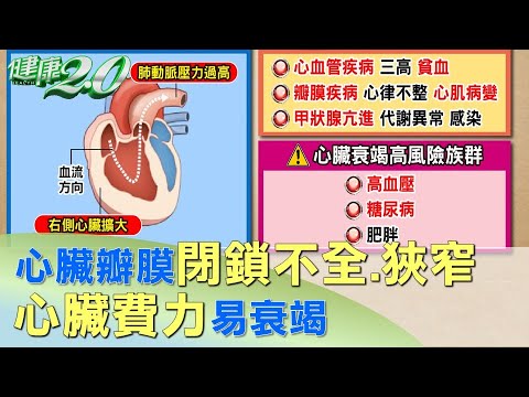 狹窄、退化症狀    微創心瓣植入手術知多少      健康2.0