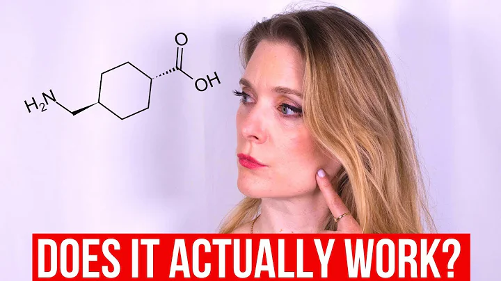 Tranexamic Acid for hyperpigmentation - Does it work?