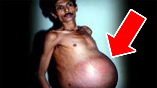 This Man Gives Birth To The Most Unexpected Thing and it is…