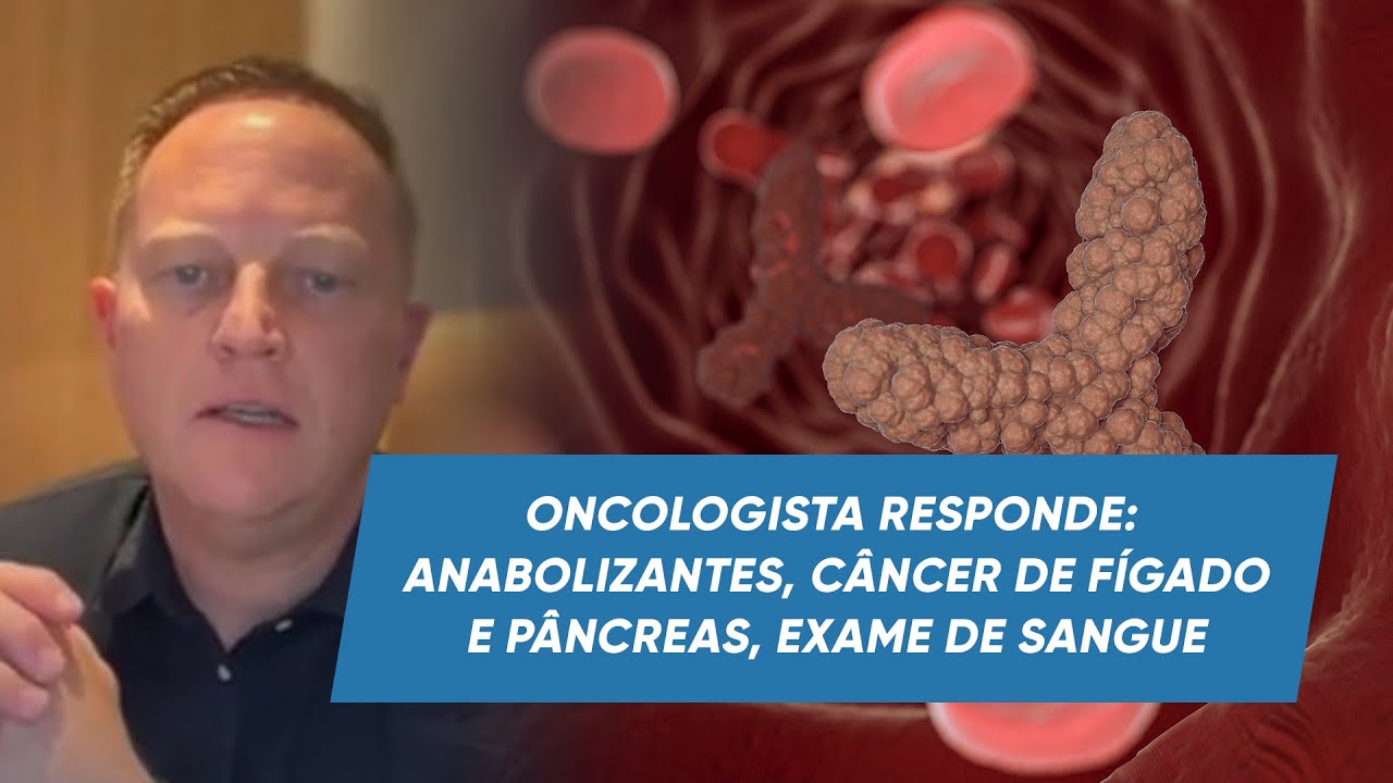 Oncologista Responde: Anabolizantes, Câncer de Fígado e Pâncreas, Exame ...