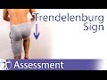 Trendelenburg Sign⎟Hip Abductors