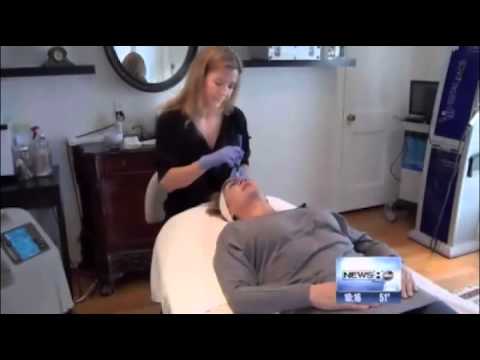dermapen results MicroNeedling SkinPen skincare system | Pittsburgh