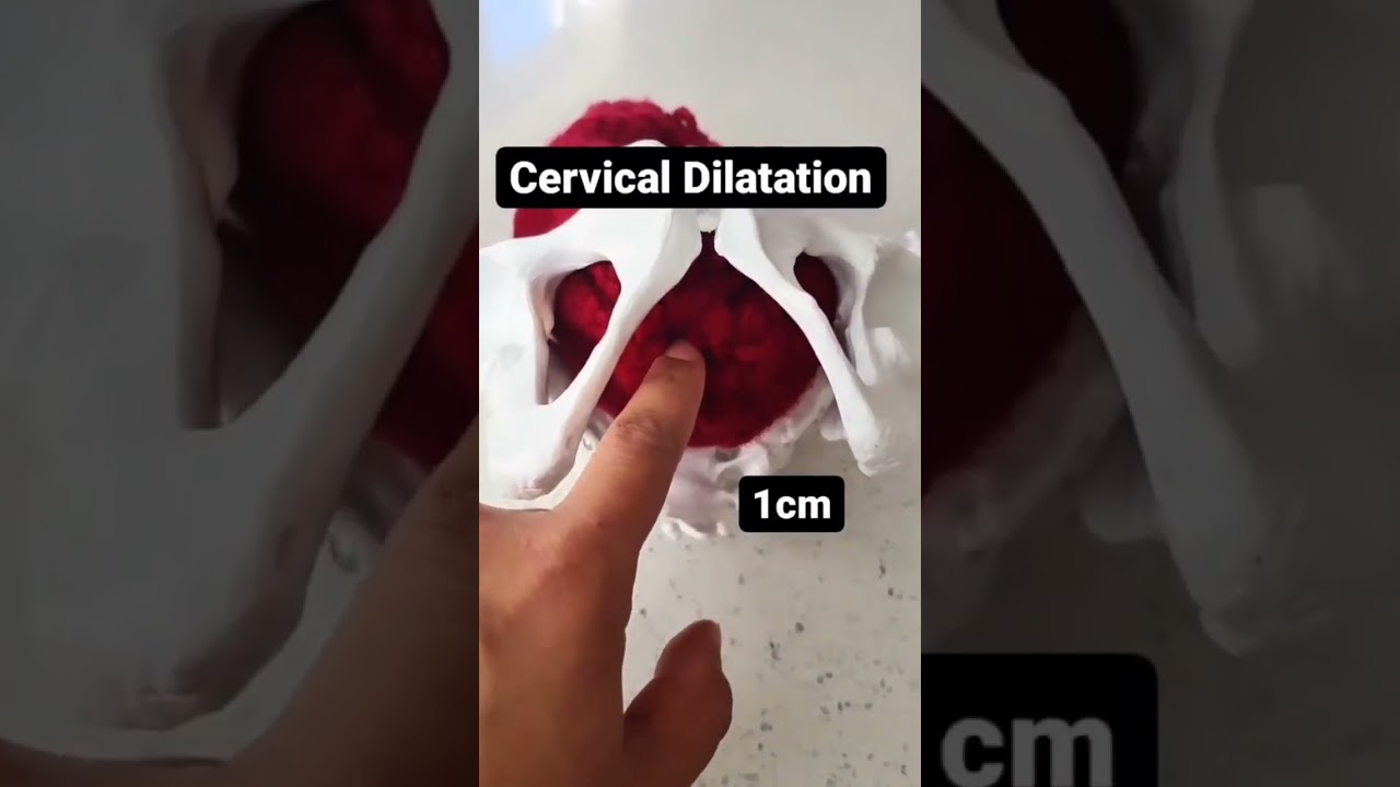 How the cervix dilated. Cervical dilation in 20 seconds
