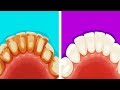 8 Manières Efficaces de se Débarrasser Naturellement De la Plaque Dentaire