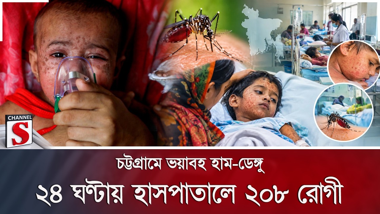 চট্টগ্রামে ভয়াবহ হাম-ডেঙ্গু; ২৪ ঘণ্টায় হাসপাতালে ২০৮ রোগী | Channel S News
