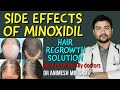 Side effects of minoxidil hair solutionwhen to use  when not to use side effects    