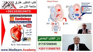 Ventricular Septal Defect (VSD) #cme #internal_medicine #ecg #usmle #medical #محاضرات_باطنة