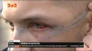 В торговельному центрі Житомира сталась кривава бійка В торговельному центрі Житомира сталась кривава бійка
