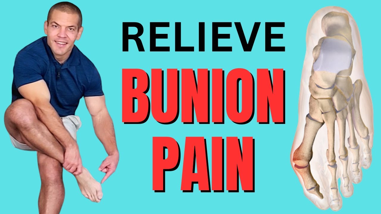 5 Secret Tricks to Treat Bunion Pain in Big Toe Without Surgery YouTube