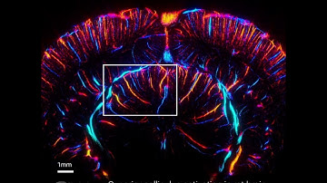 Functional ULM Imaging