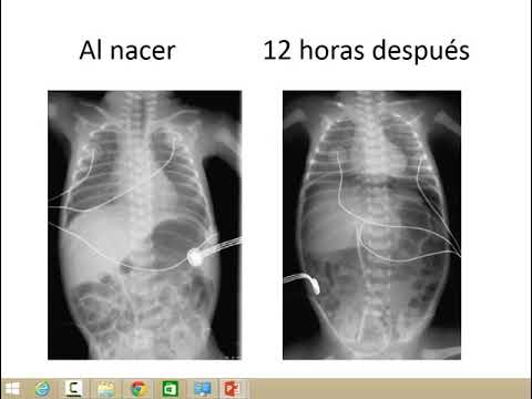 CT ENAM - Neonatología 1V 1