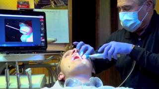 Periodontal Probe