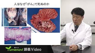 【夢ナビ講義動画／臨床検査学科 森誠司教授】がん転移のメカニズムを知る