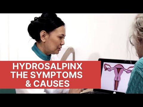 Video: Hydrosalpinx: Gejala, Rawatan, Gambar, Sebab