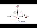 Electrocardiogram Waves (P-QRS-T Waves) - MEDZCOOL