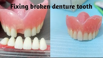 How to fix broken denture tooth