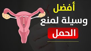 أبرز المعلومات عن اللولب الهرموني لمنع الحمل