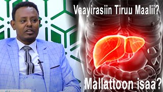 Tiruu, Vaayirasii Tiruu fi Mallattoowwan Vaayirasii Tiruu #Yookoo Doctor Dr. Fiqaaduu Girmaa