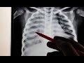 محاضرة: X Ray Imaging Radiation Safety السلامة من مخاطر الاشعاع عند التصويربأشعة اكس(الاشعة السينية)